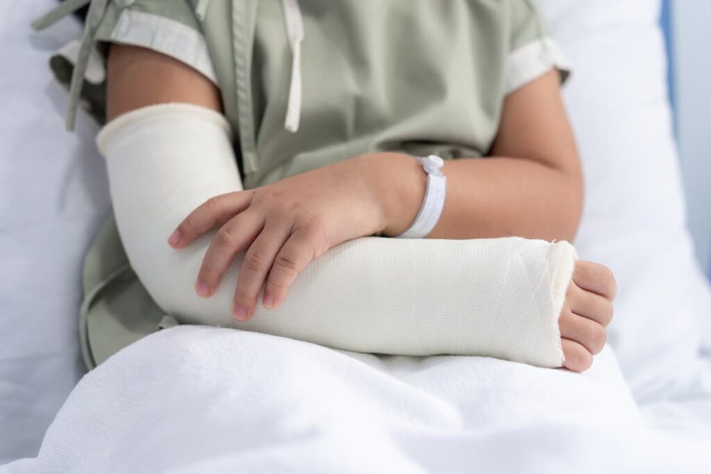 Bone fractures due to accidents