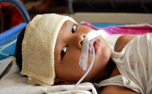 Encephalitis What Are The Symptoms And How Can It Be